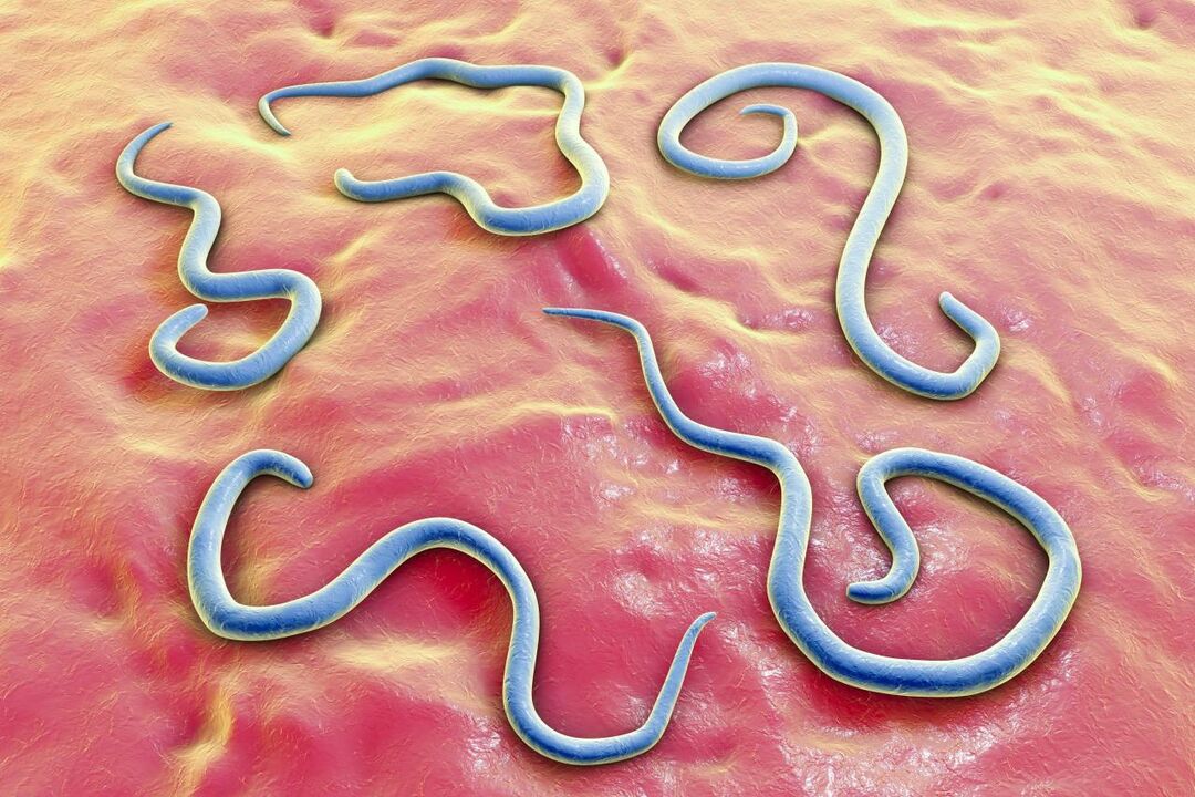 parazitski crvi u ljudskom tijelu