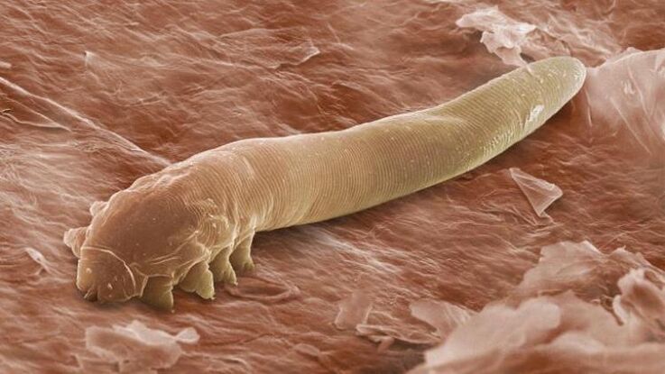 crv koji živi ispod ljudske kože