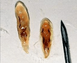 Opistorhi