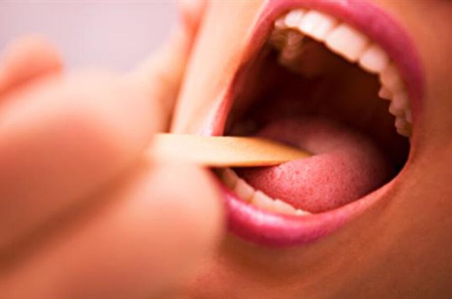 Vrste parazita u ljudskim ustima